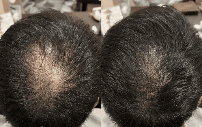 02 分け目やつむじ周が気になる