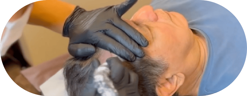 01 痛みを抑えた、快適なスカルプタトゥー体験