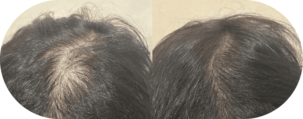 04 その日から、少しずつ変わる実感