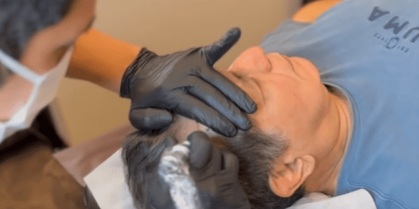 STEP04 2回目以降の施術