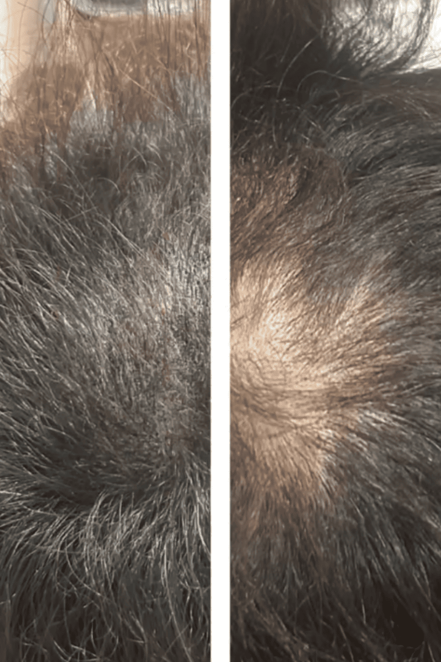 03 バレずに即日対策！